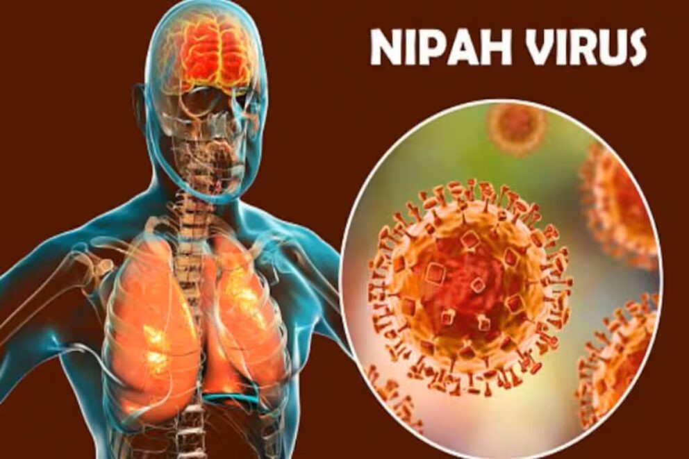 निपाह भाइरस फैलिन नदिन उच्च शतर्कता, भारतसँग जाेडिएका पश्चिमी सबै नाकामा कडा निगरानी